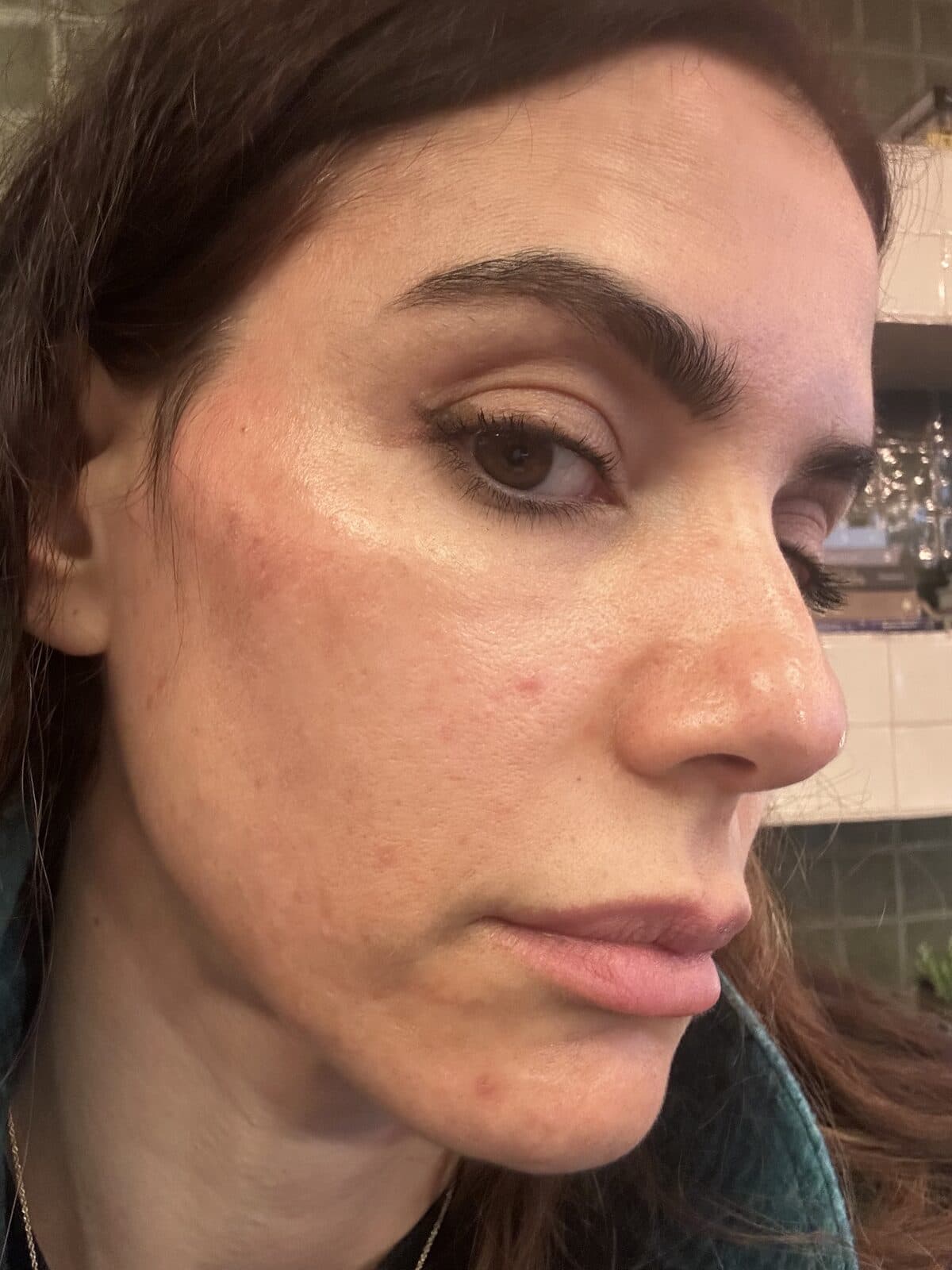 Same area showing calmed skin