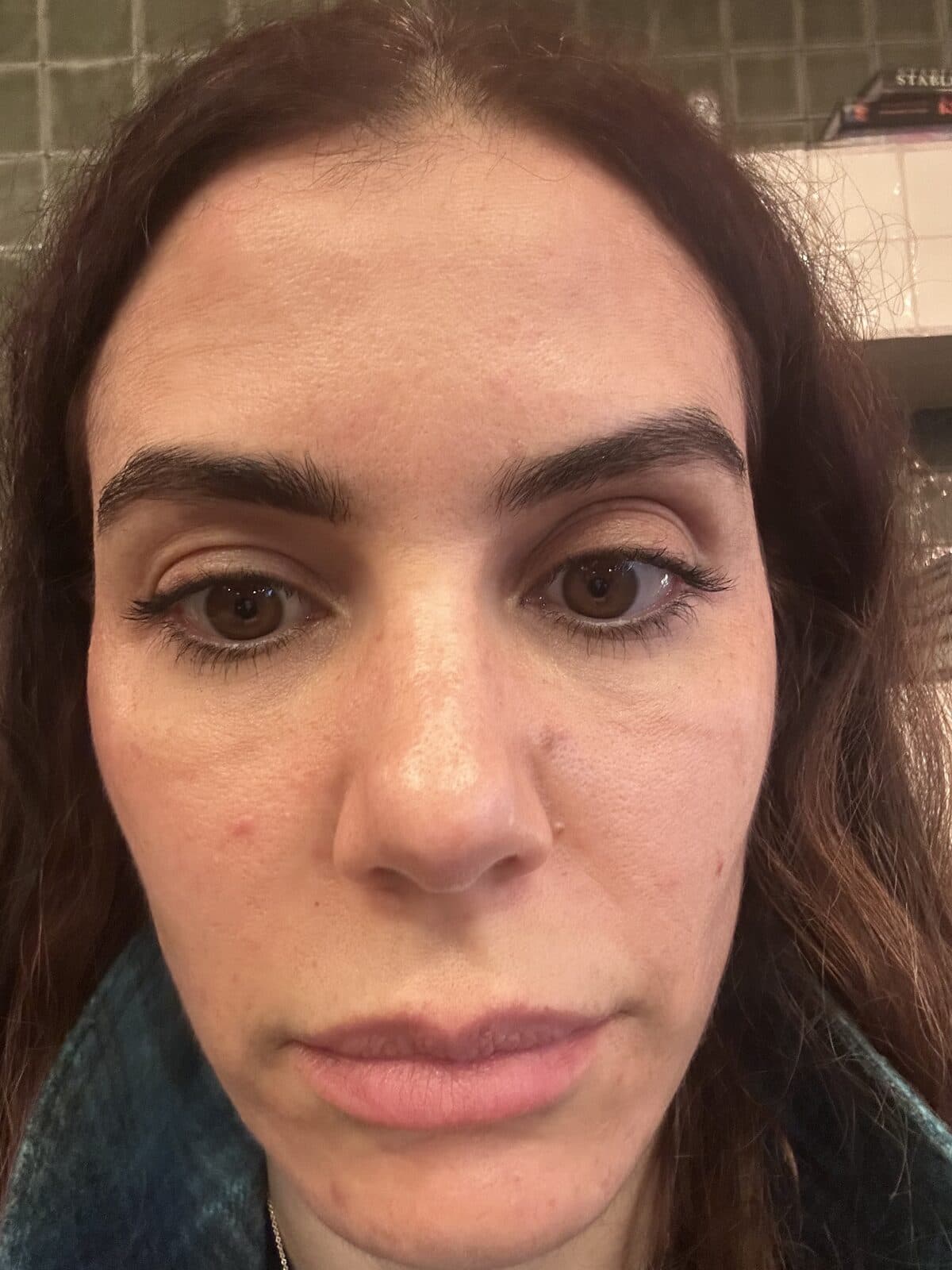Front view showing reduced redness